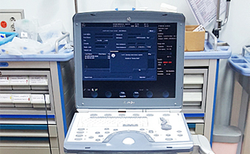 이동식 심초음파기 사진