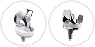 인공 슬관절 사진