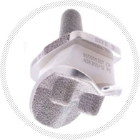 인공 족관절 사진