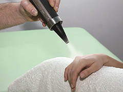 극저온스프레이(Crotherapy) 사진